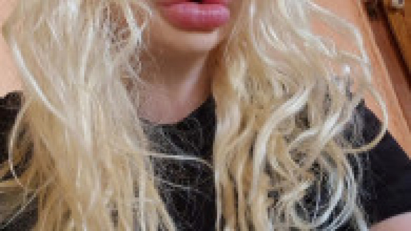 Andrea Ivanova, o femeie din Bulgaria cunoscută pe internet ca fiind deținătoarea "celor mai mari buze din lume", a recurs la noi injecții pentru echilibra trăsăturile feței. Sursa foto: Profimedia Images | Poza 2 din 9